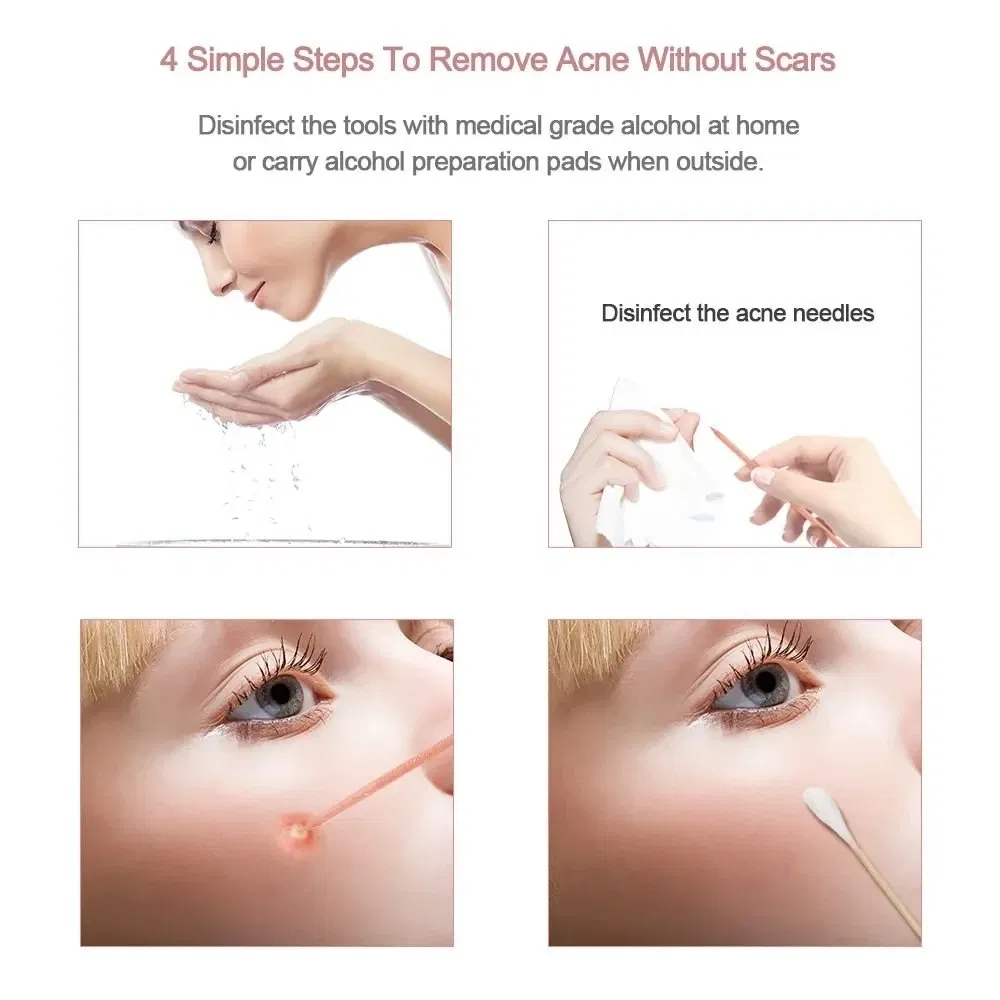 Color: WHITE - 4PCS Stainless Steel Acne Needle Electroplating Colorful Rose Gold Acne Needle Extrusion Blackhead Tool Can Be Customized LOGO - Image 7