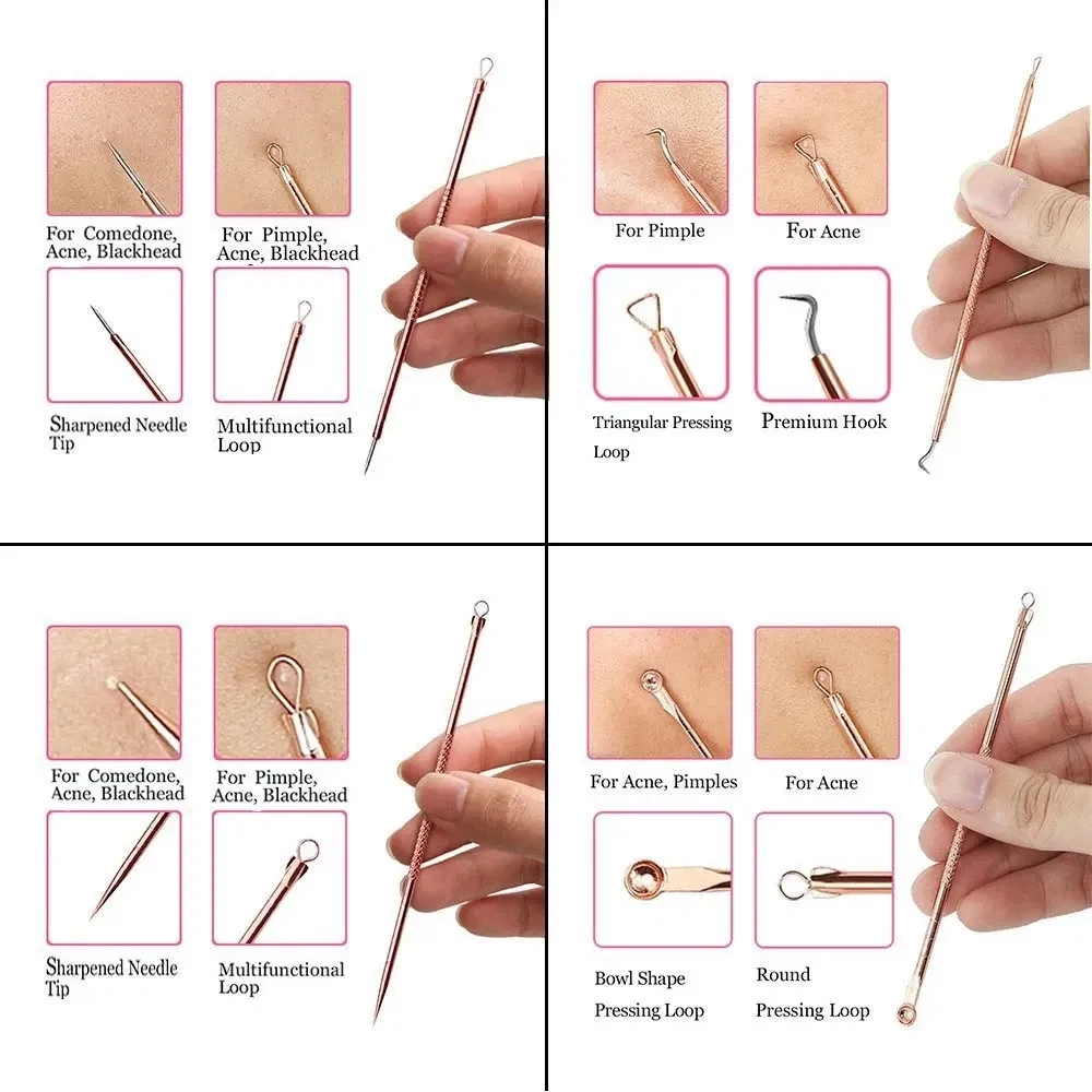 Color: WHITE - 4PCS Stainless Steel Acne Needle Electroplating Colorful Rose Gold Acne Needle Extrusion Blackhead Tool Can Be Customized LOGO - Image 6